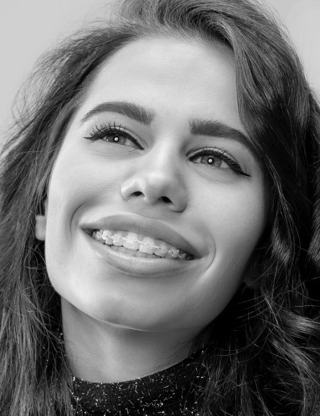 Clear Braces brooklyn