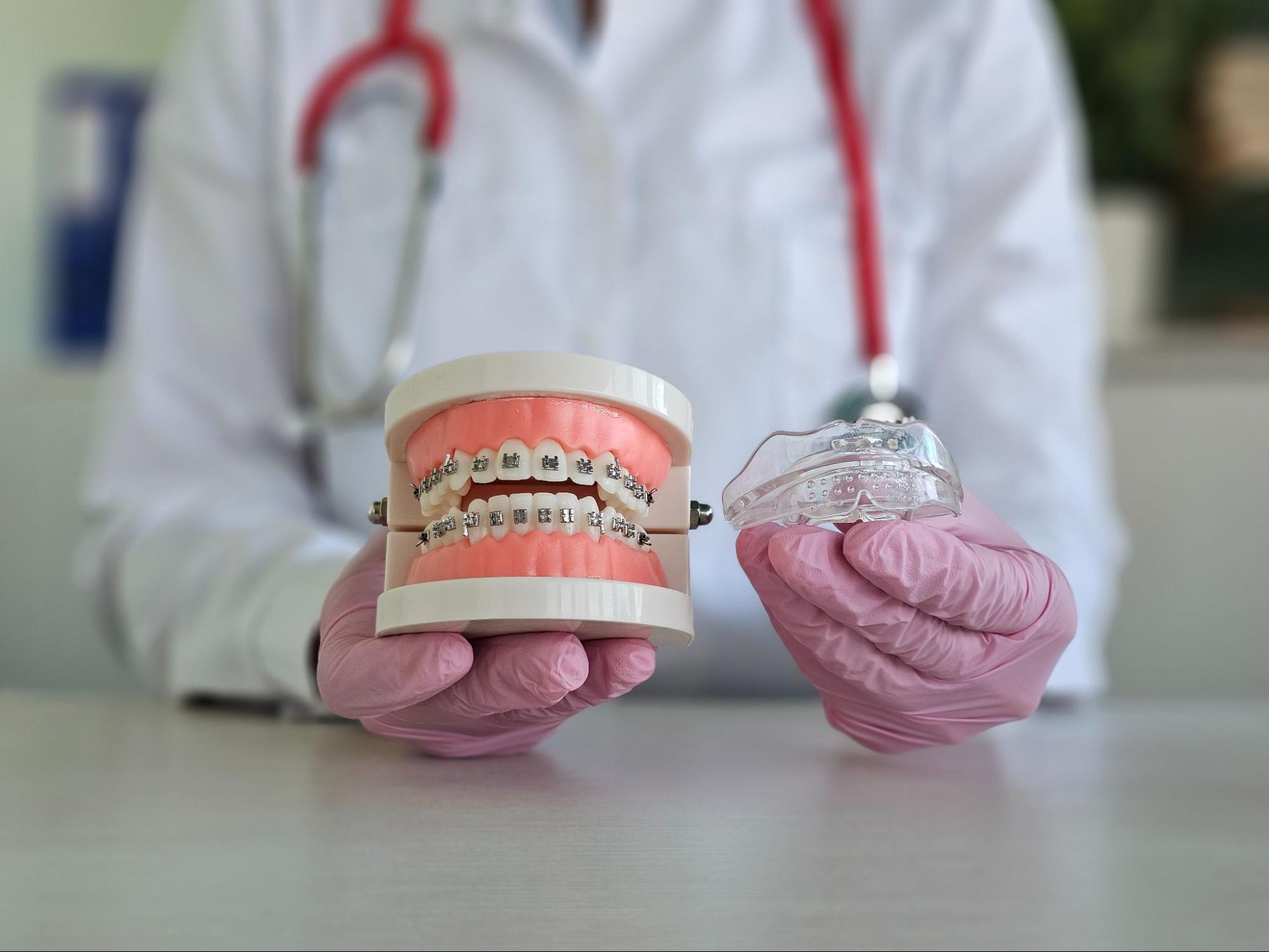 Choosing Between Metal and Clear Braces